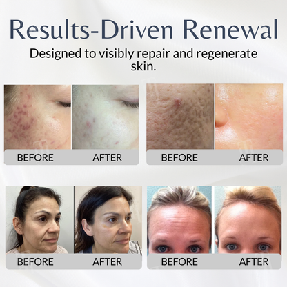 🌿AEXZR® Cellular Renewal System -🧬The Ultimate Deep Scar Repair Kit ✨