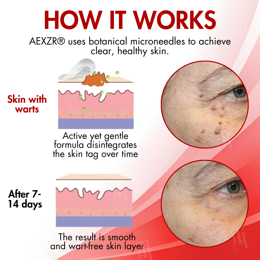 ✨AEXZR® Nano-Microdart Skin Tag & Spot Corrector Patches -🩹 Dual-Release Tech, Painless Removal🌿