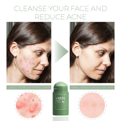 ✨DeepPurifying Green Tea Clay StickMask -💧Mess-Free Application, Blackhead Removal🌿